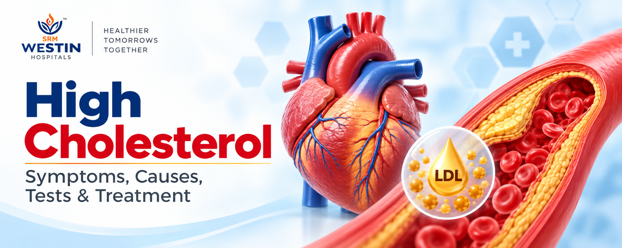 High cholesterol symptoms causes lipid profile tests and treatment at Westin Hospitals